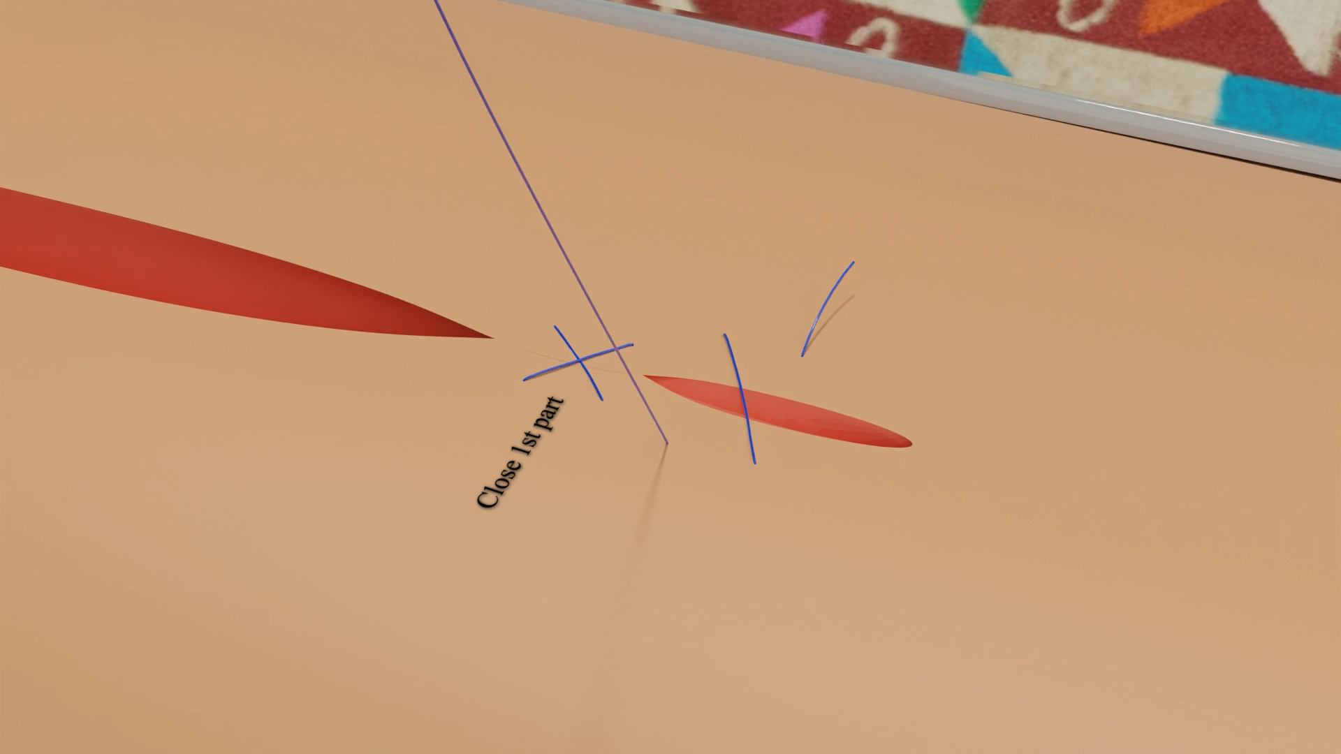 3D animation of Running Cruciate Suture used in surgical training