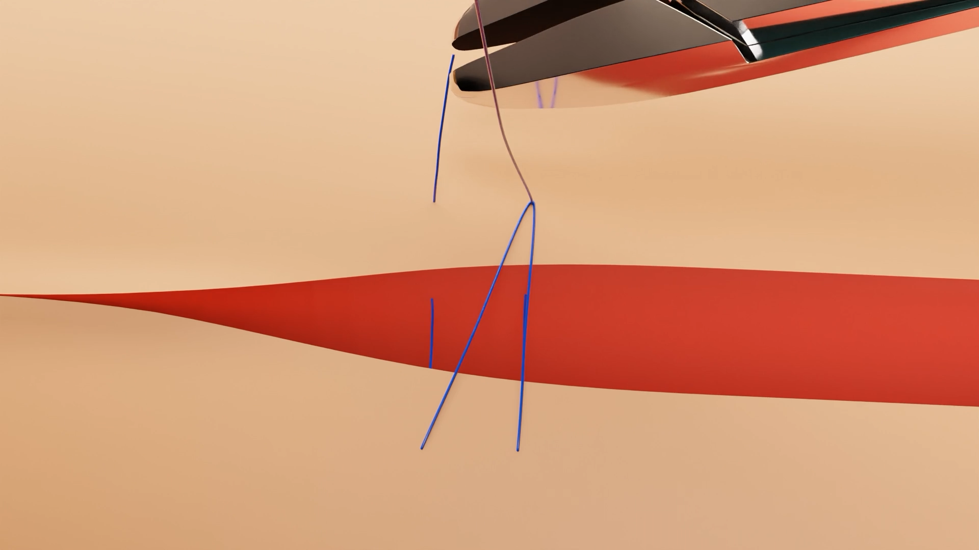 3D animation of Horizontal Mattress Pulley Suture used in surgical training