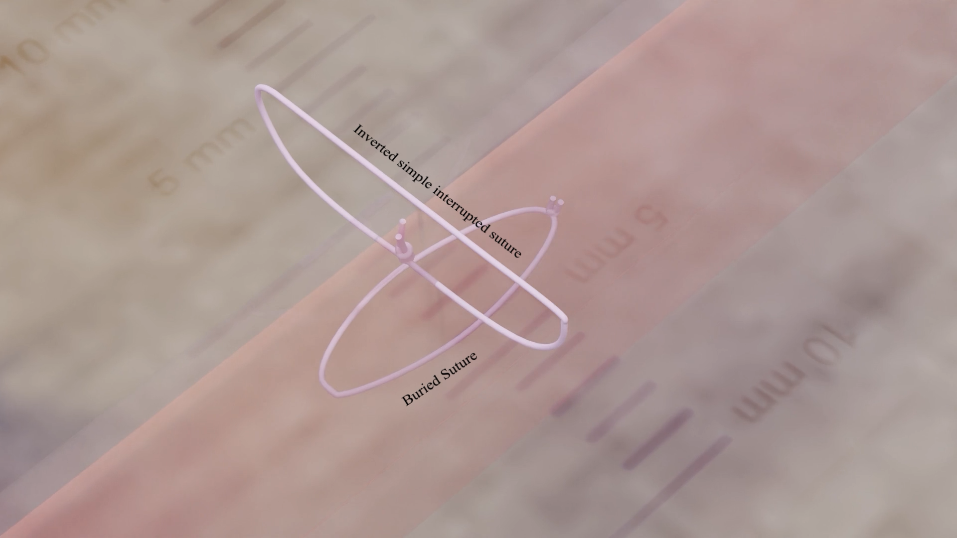 3D animation of Simple Buried Suture used in surgical training