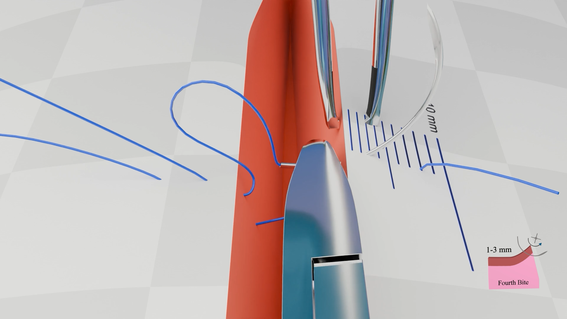 3D animation of Vertical Mattress Suture used in surgical training